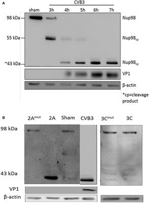 Cleavage and Sub-Cellular Redistribution of Nuclear Pore Protein 98 by Coxsackievirus B3 Protease 2A Impairs Cardioprotection